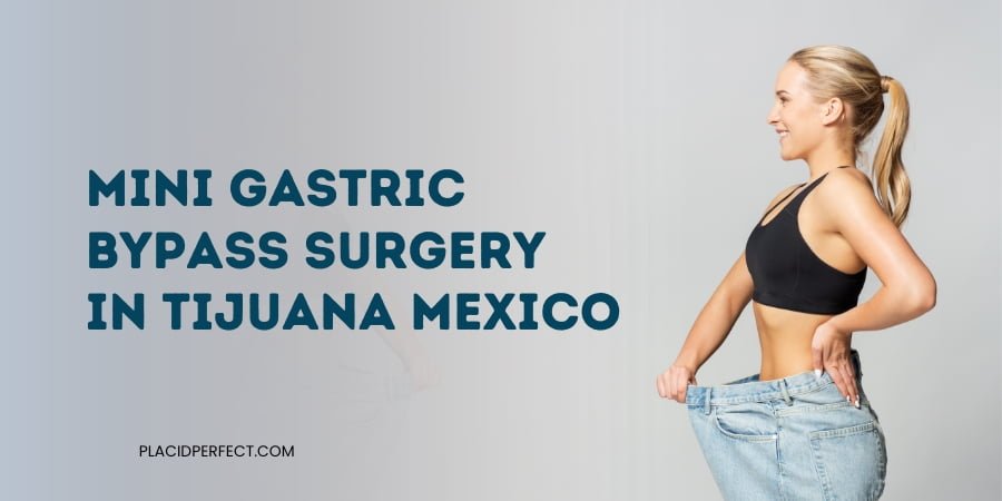 Mini Gastric Bypass Surgery In Tijuana Mexico