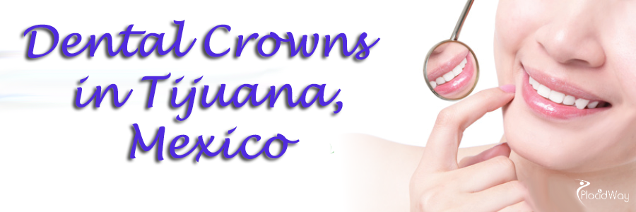 Dental Crowns in Tijuana Mexico