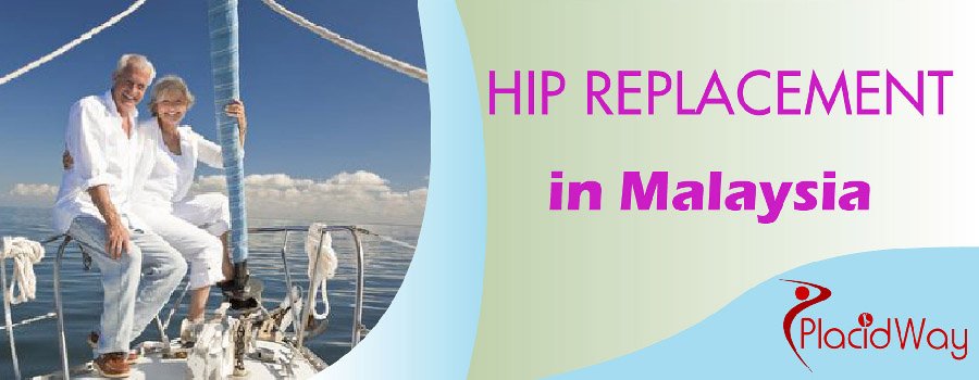 Hip Replacement Packages in Malaysia