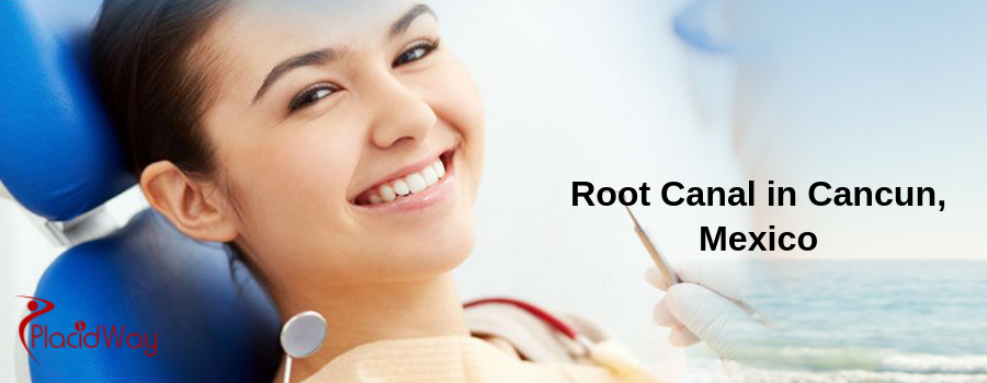 Root Canal Package in Cancun, Mexico