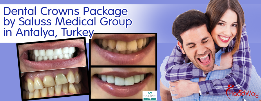 Dental Crowns Package in Antalya, Turkey