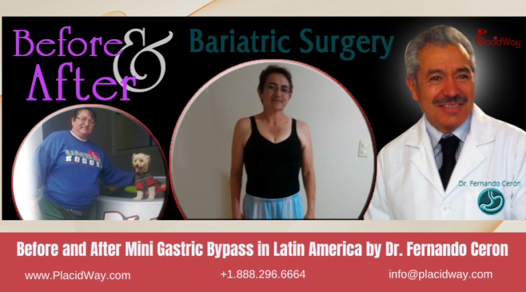 Best Surgeons for Mini Gastric Bypass in Latin America
