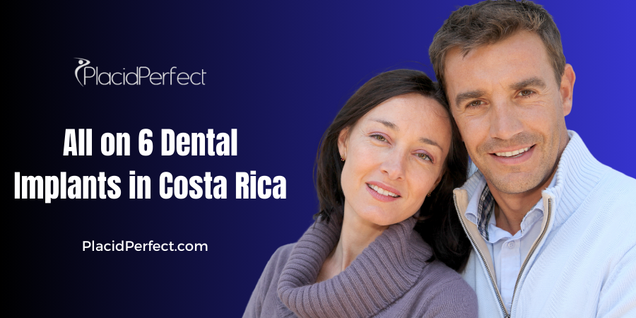 All on 6 Dental Implants in Costa Rica