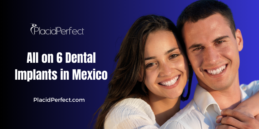 All on 6 Dental Implants in Mexico