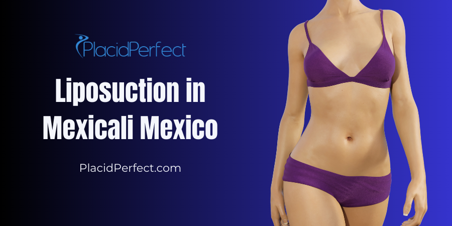 Liposuction in Mexicali Mexico