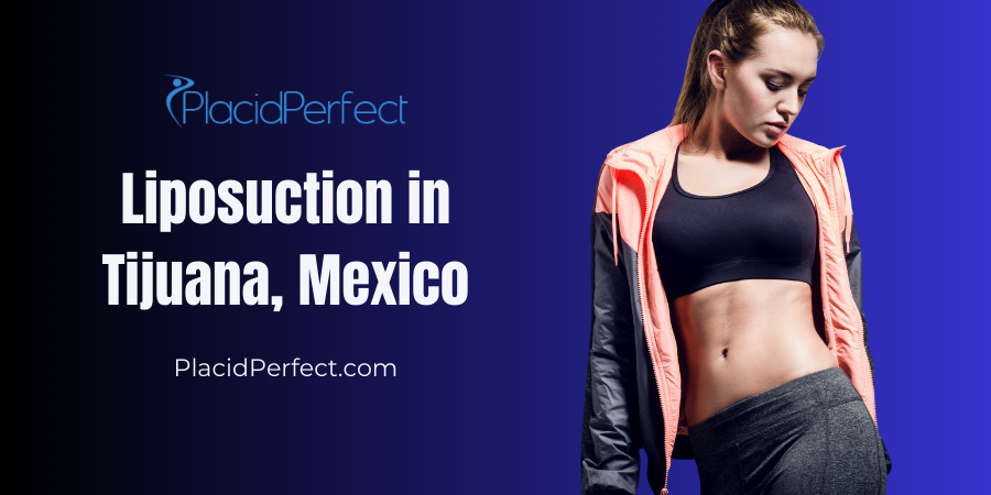 Liposuction in Tijuana, Mexico