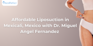 Affordable Liposuction in Mexicali, Mexico with Dr. Miguel Angel Fernandez