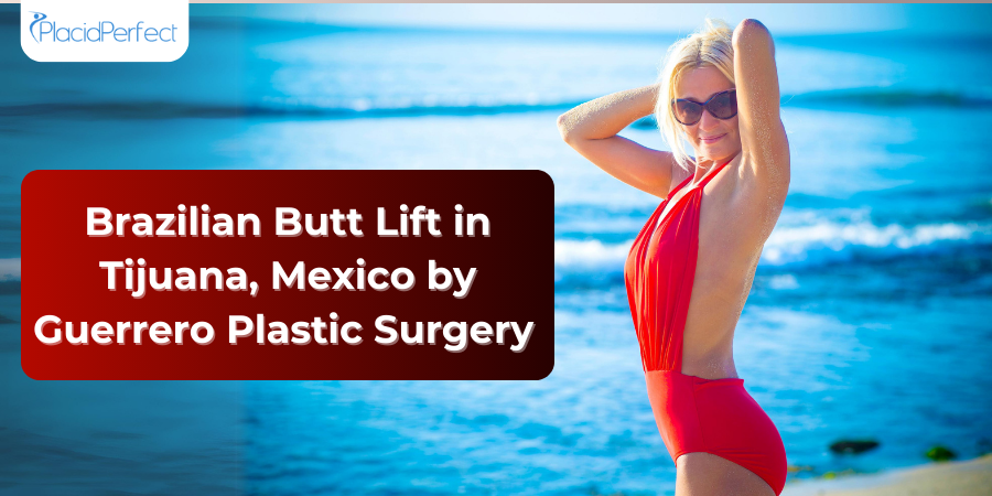 Brazilian Butt Lift in Tijuana, Mexico by Guerrero Plastic Surgery