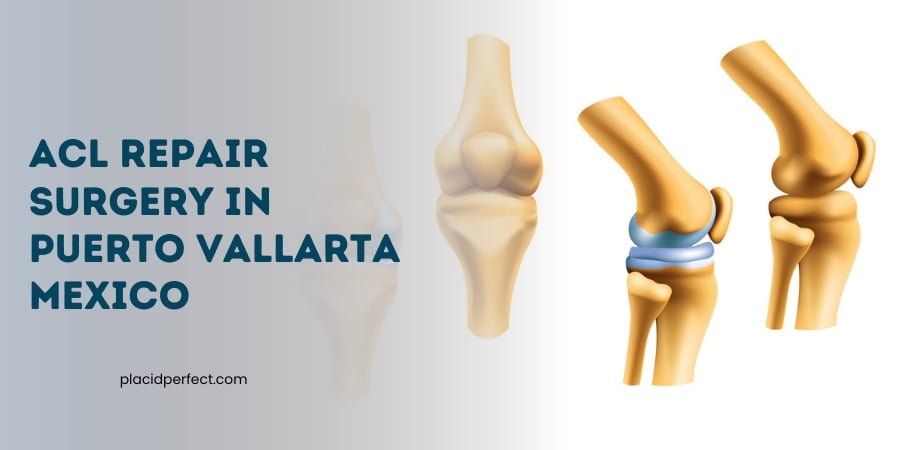 ACL Repair Surgery in Puerto Vallarta Mexico