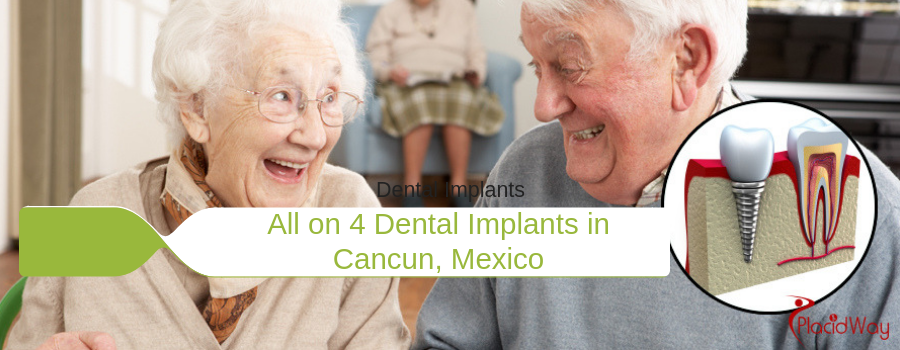 All on 4 Dental Implants in Cancun, Mexico