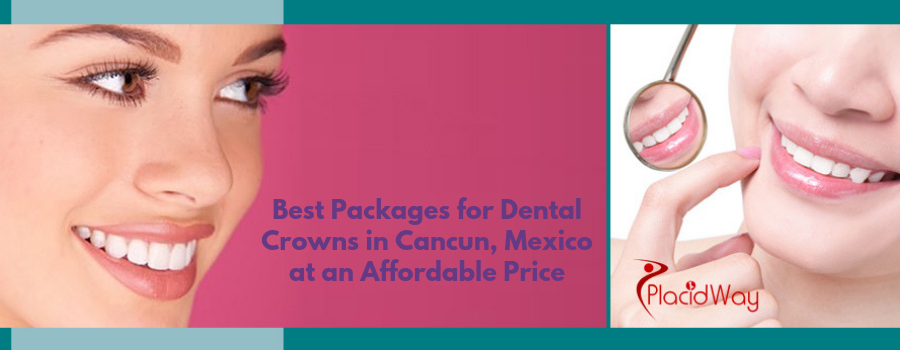 Best Packages for Dental Crowns in Cancun, Mexico at an Affordable price