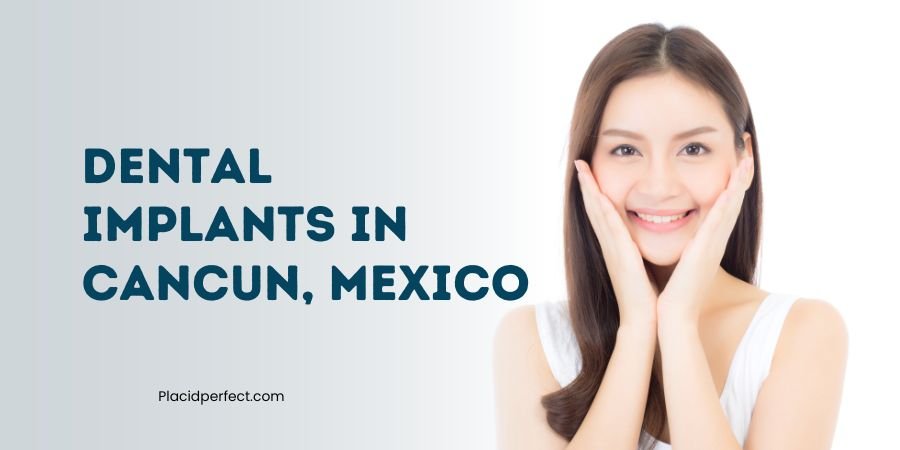 Dental Implants in Cancun, Mexico