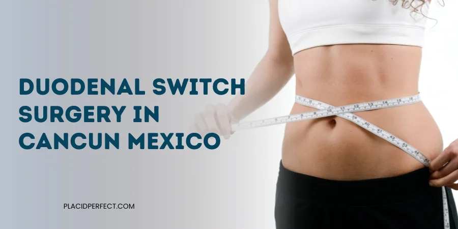 Duodenal Switch Surgery in Cancun Mexico