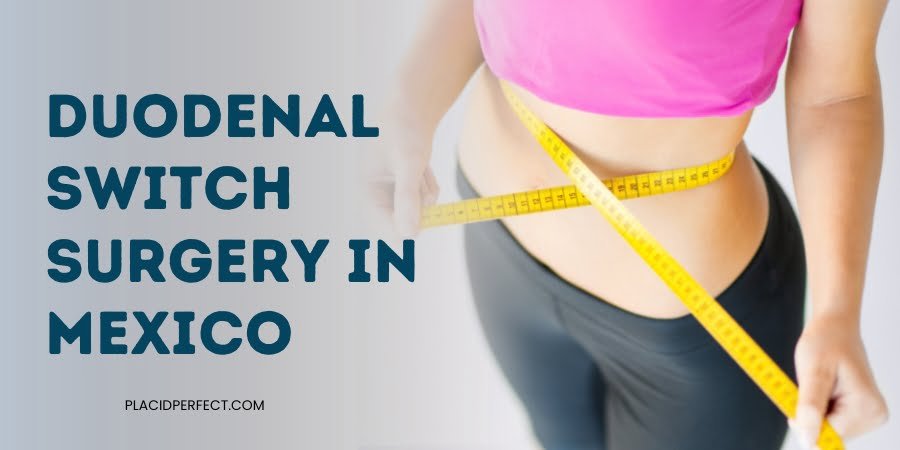 Duodenal Switch Surgery in Mexico