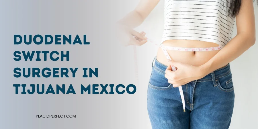 Duodenal Switch Surgery in Tijuana Mexico