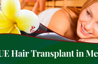 FUE Hair Transplant in Mexico