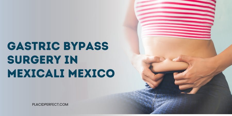 Gastric Bypass Surgery in Mexicali Mexico