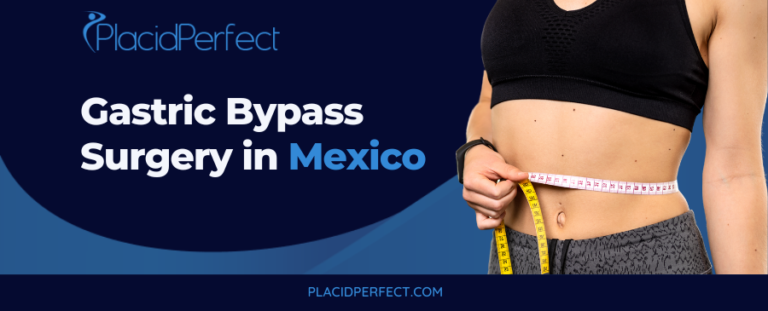 Gastric Bypass Surgery in Mexico - A Cost Effective Option