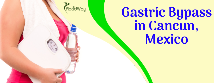 Gastric Bypass in Cancun Mexico