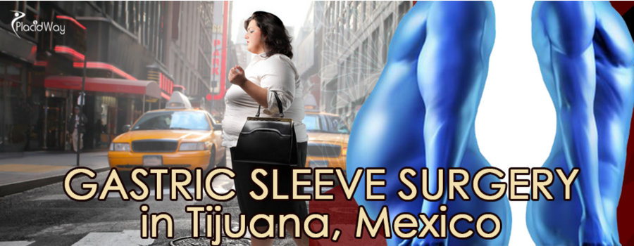 Gastric Sleeve Surgery Tijuana Mexico