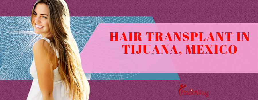 Hair Transplant in Tijuana, Mexico