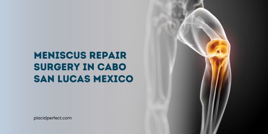 Meniscus Repair Surgery in Cabo San Lucas Mexico