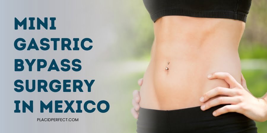 Mini Gastric Bypass Surgery in Mexico