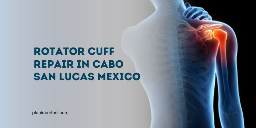 Rotator Cuff Repair in Cabo San Lucas Mexico