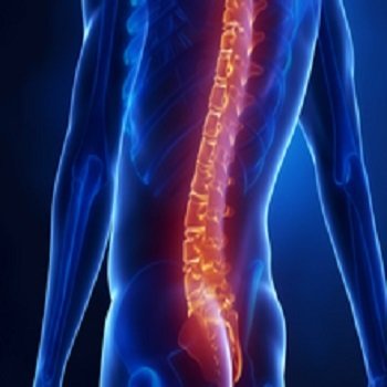 Top Spine Surgery Packages in India | PlacidPerfect